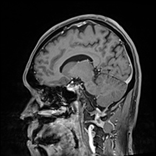 Click on the Serie image to view the images of VILLANUEVA, WILLIAM A.